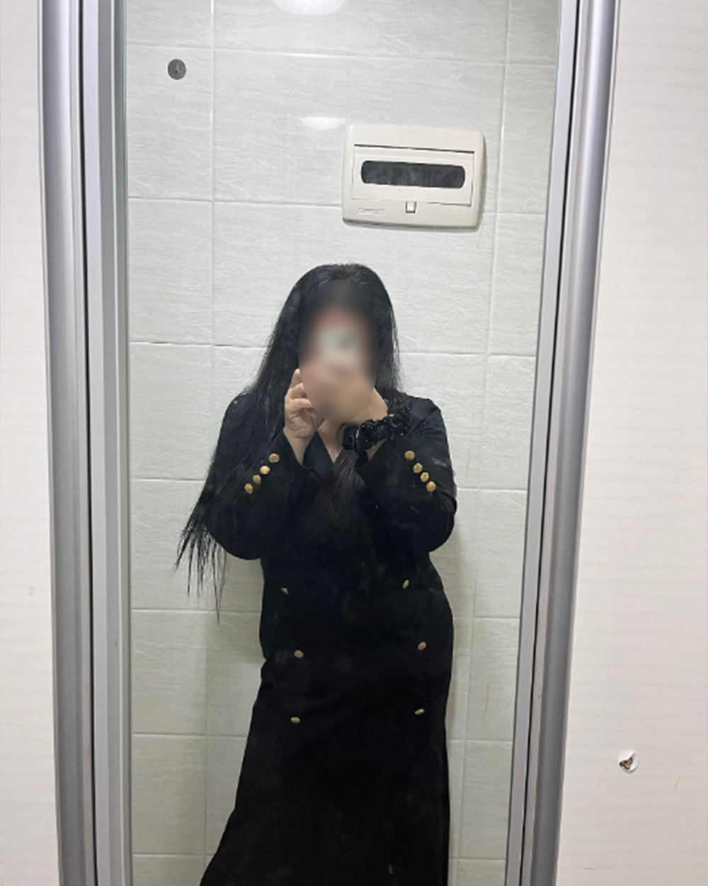 After: 위 절제술 전/후 (2023.02.08)