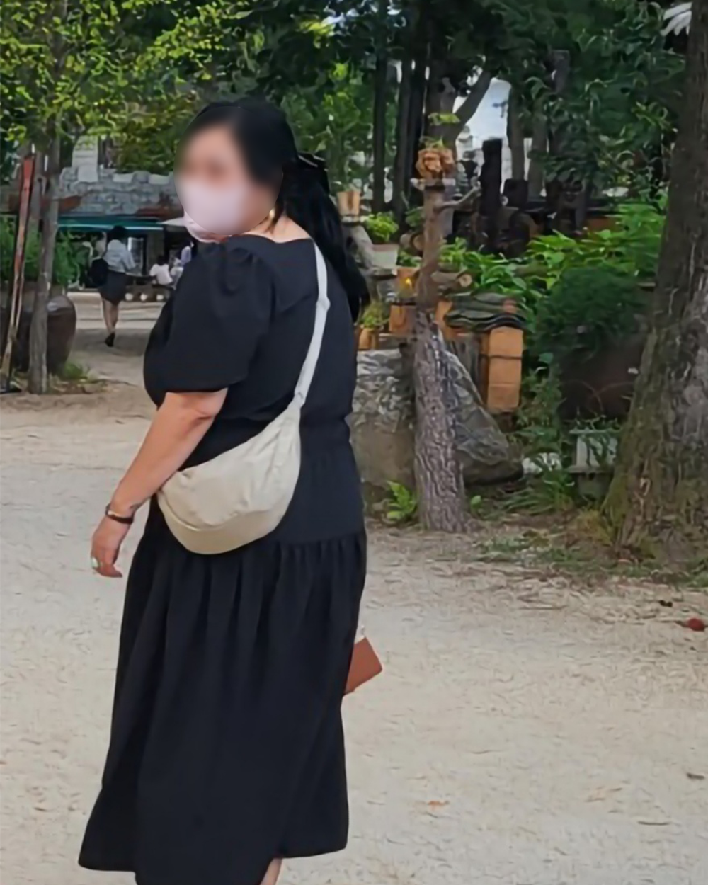 Before: 십이지장 우회술 전/후 (2024.04.24)